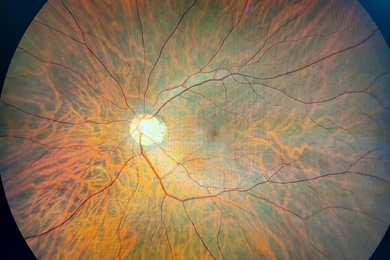 Retinal Scan of an Eye