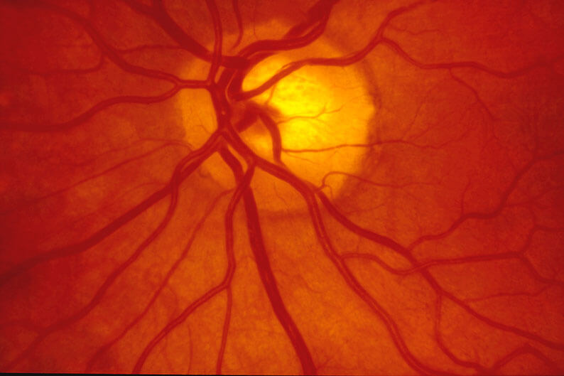Retinal Scan of an Eye